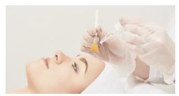 Chemical Peel