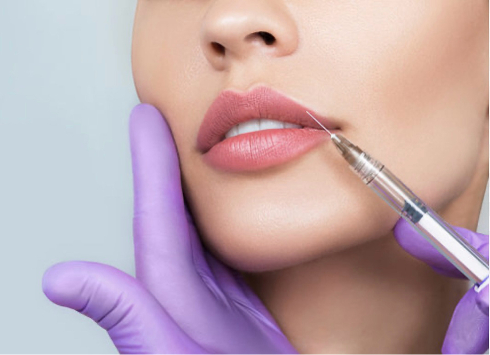 Lip Filler - Half Syringe