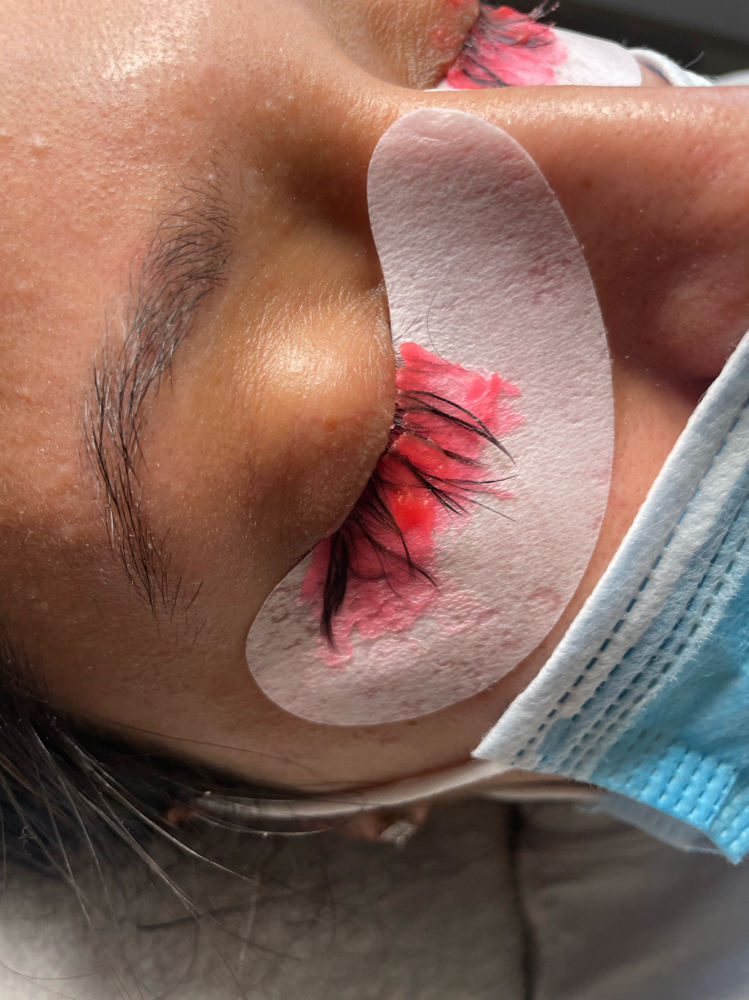 Lash Removal