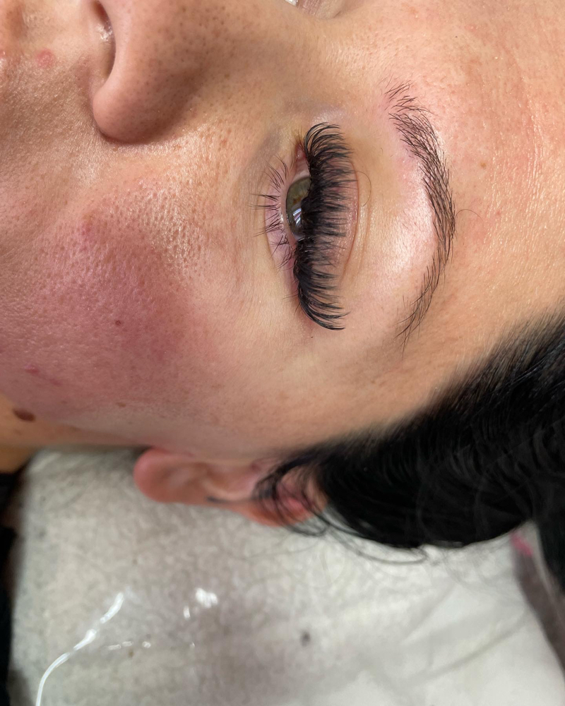 Light Volume at Blossom B Aesthetics in Bakersfield, CA