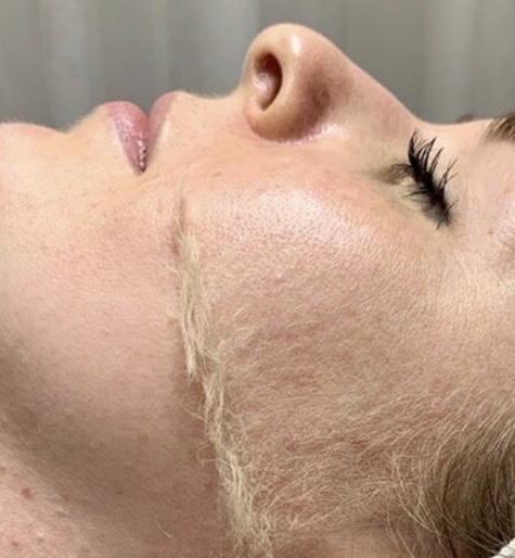 Express Dermaplaining Facial