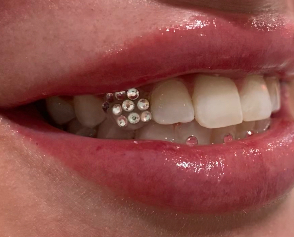 Disco Ball Tooth