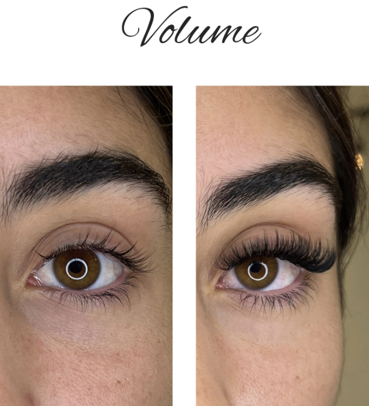 Volume Full Set