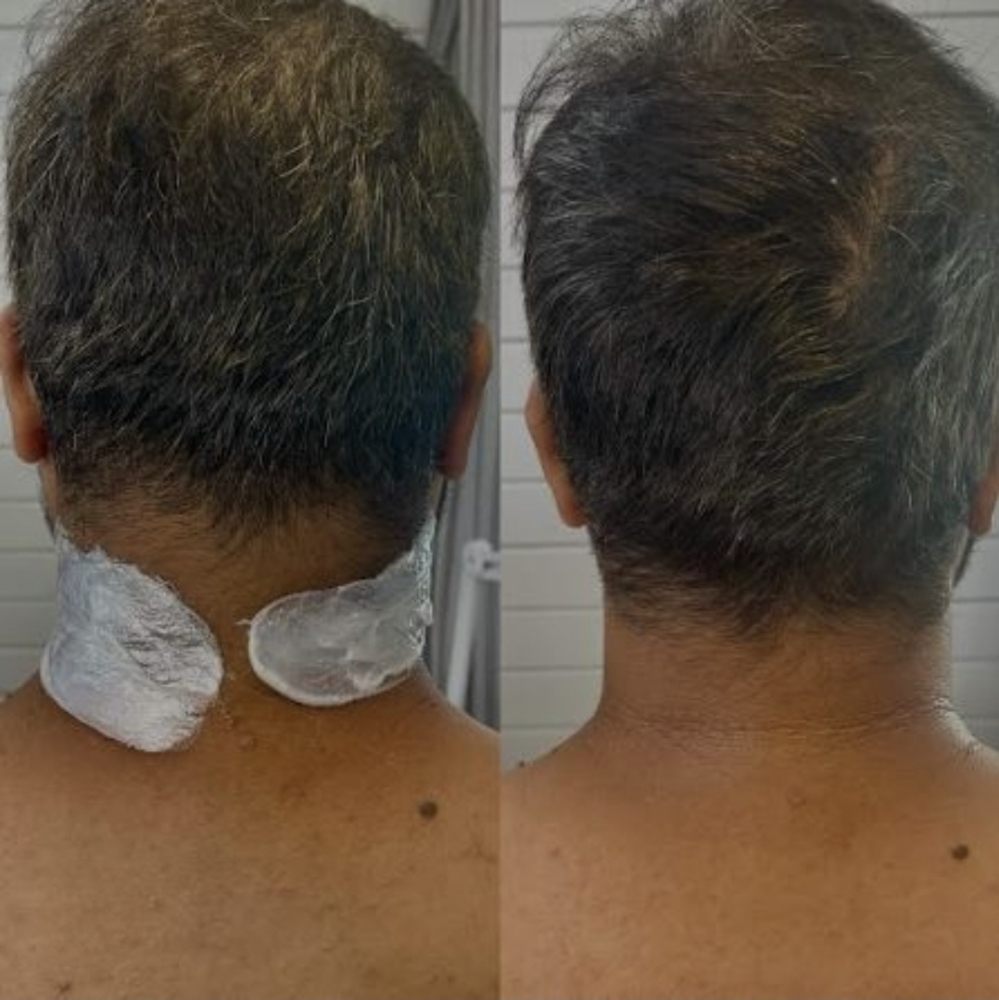 Neck / Hairline Wax
Male