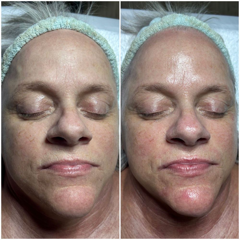 Deluxe Custom Facial