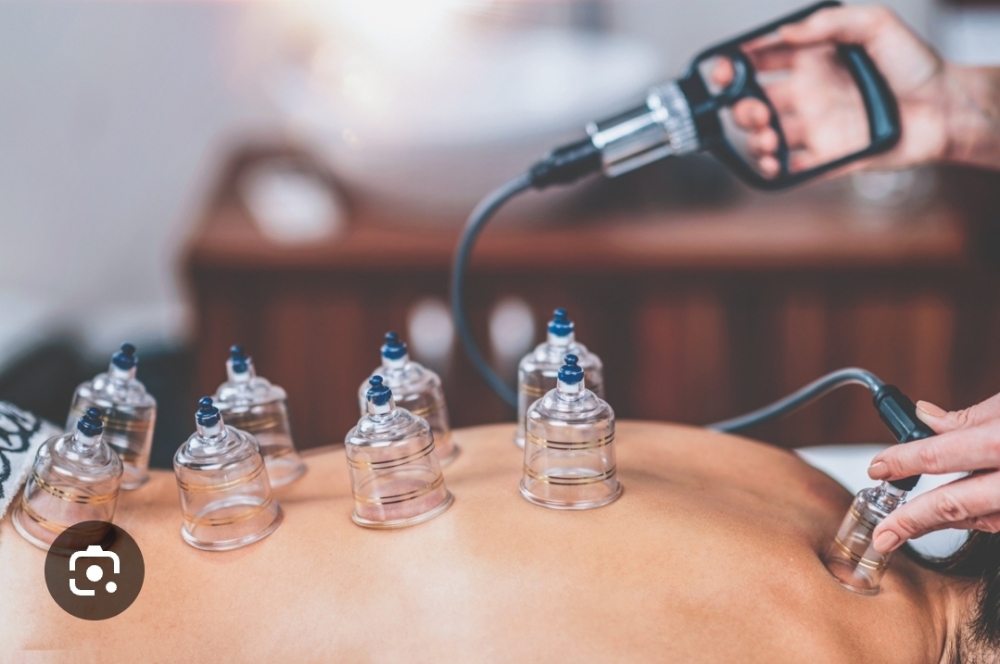Cupping Therapy Massage