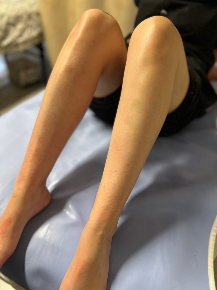 Full Leg - Waxing