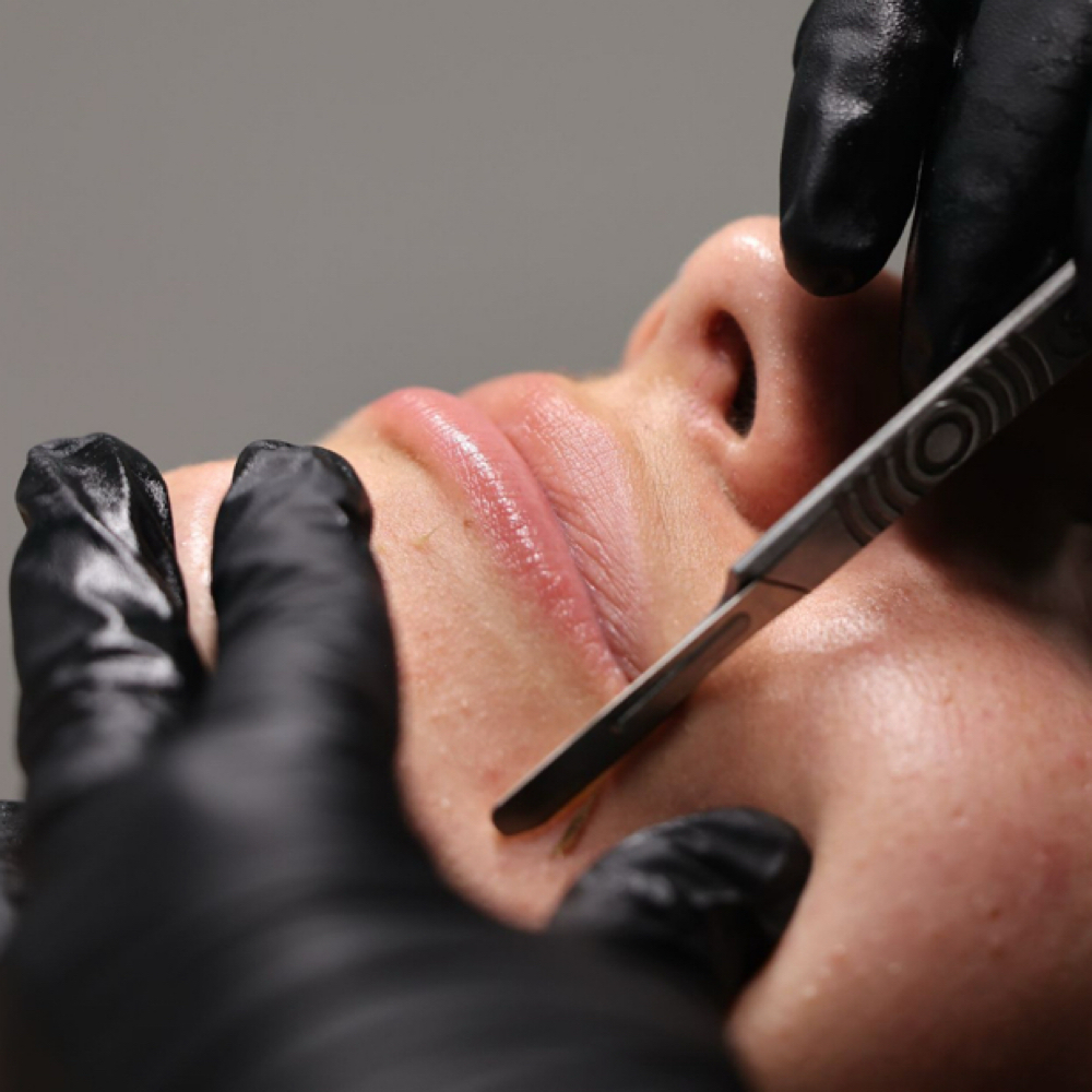 DERMAPLANING at Mattie’s Aesthetics in Aptos, CA