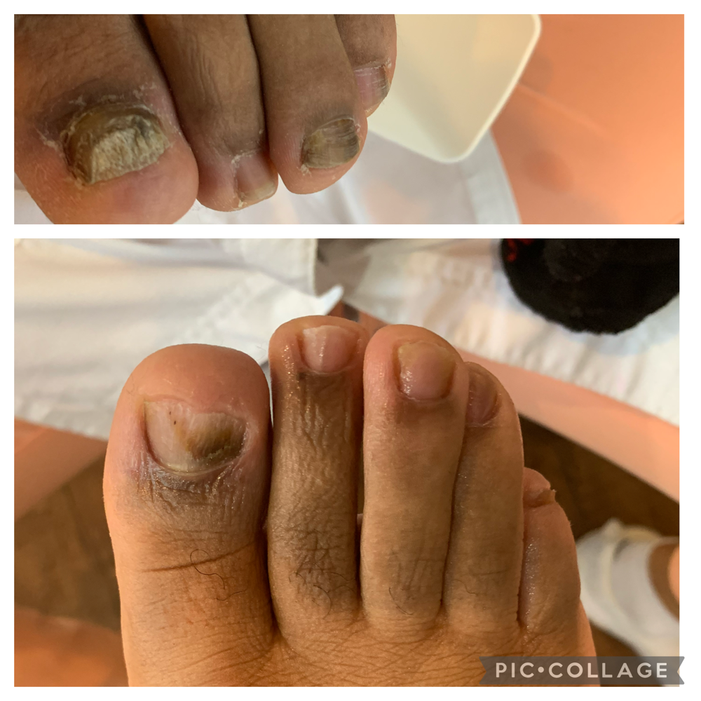 Medi Repair/Restore Pedi at The Xperience Salon & Spa in Murfreesboro, TN