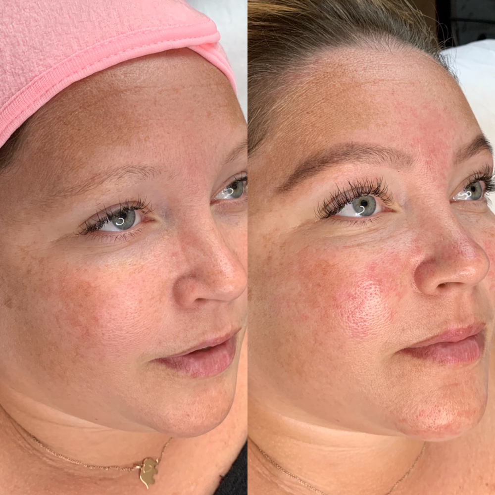 CUSTOMX FACIAL