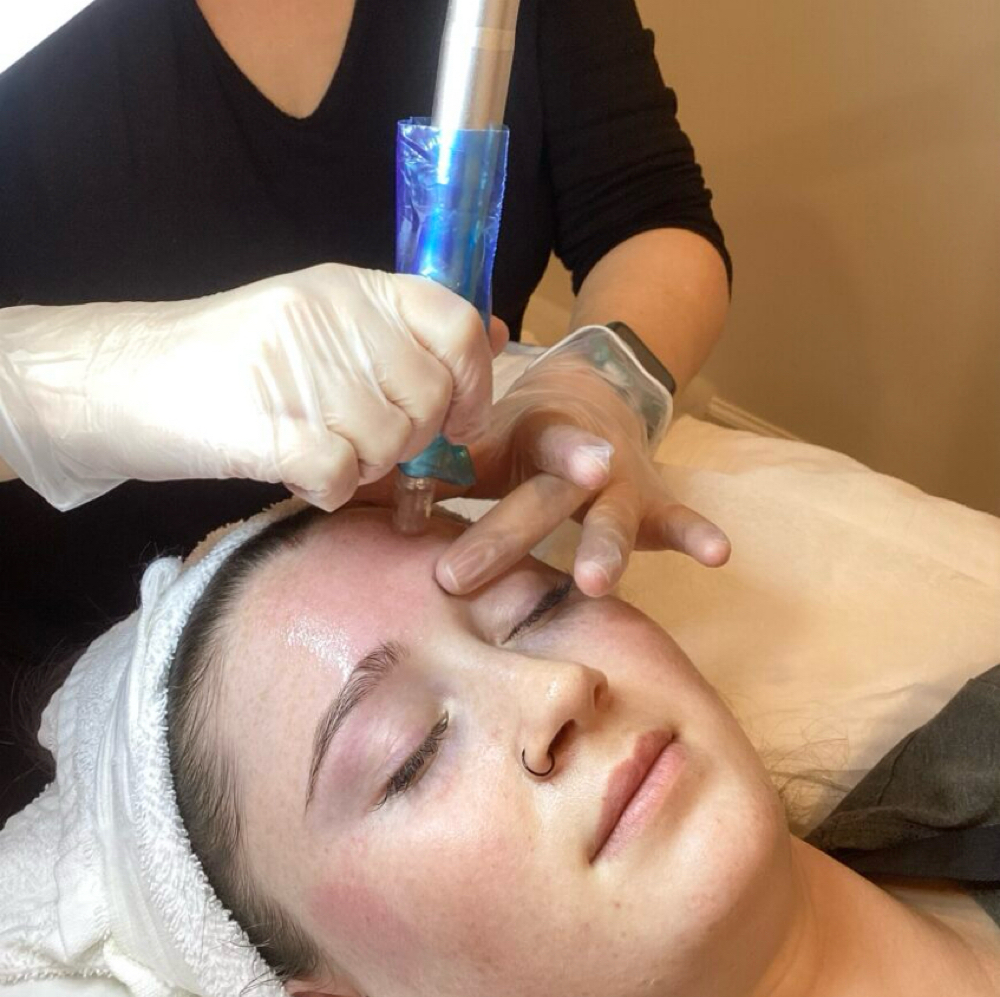 Nanoinfusion Package at Serene Beauty in Savannah, TN