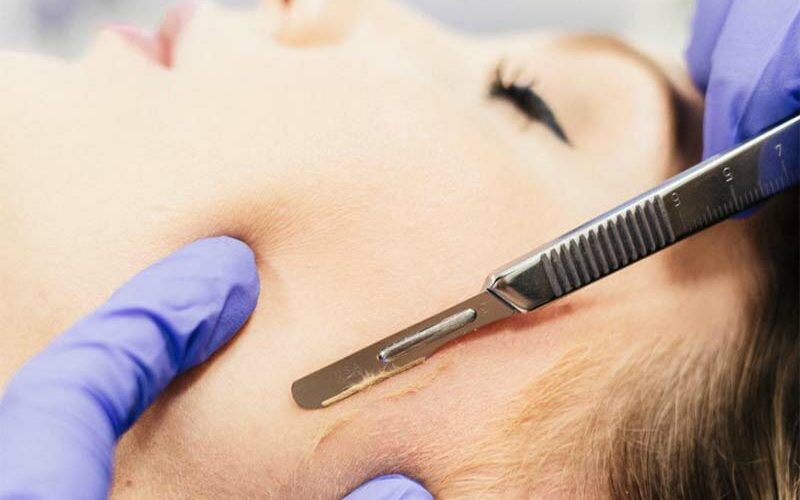 DERMAPLANING + ENZIMES  (Express)