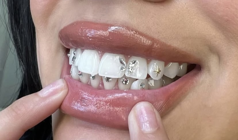 Tooth Gems