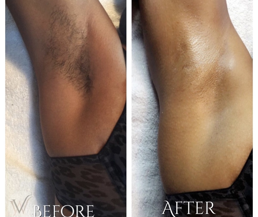 Underarm Wax