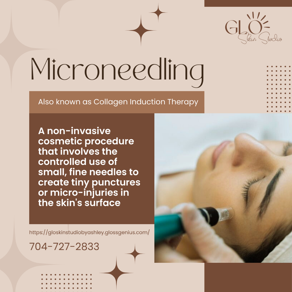 Microneedling-3 Sessions