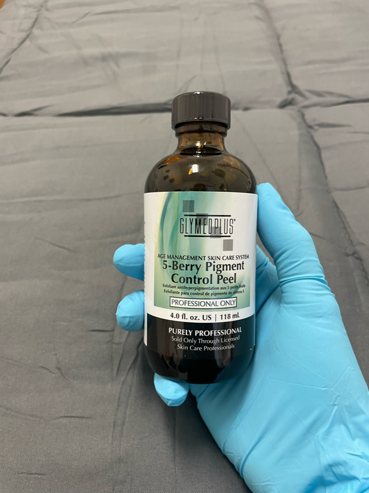 Pigment Control Chemical Peel