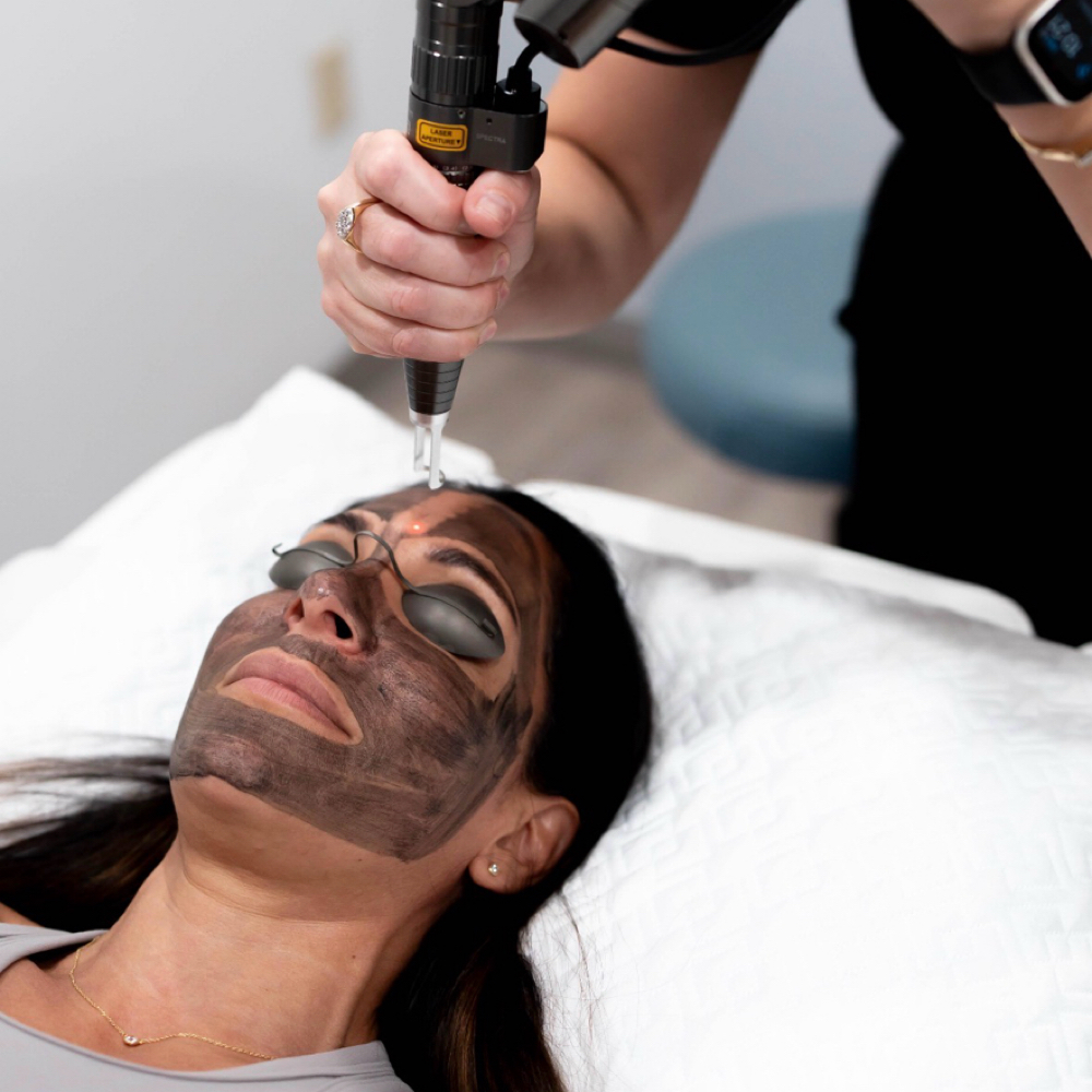 Hollywood Peel at La Belle Studio by Soraya in Woburn, MA