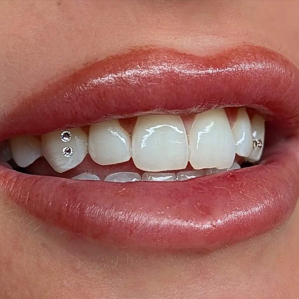 4 Tooth Gems (Swarovski Crystals) at Royal Blanc Smiles - Teeth Whitening and Tooth Gems in Charlotte, NC in Charlotte, NC