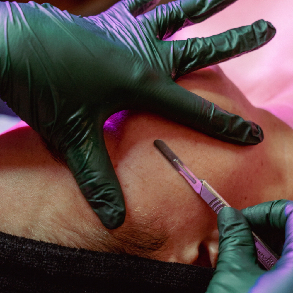 DERMAPLANE FACIAL at Eclectic Esthetics in Beech Grove, IN