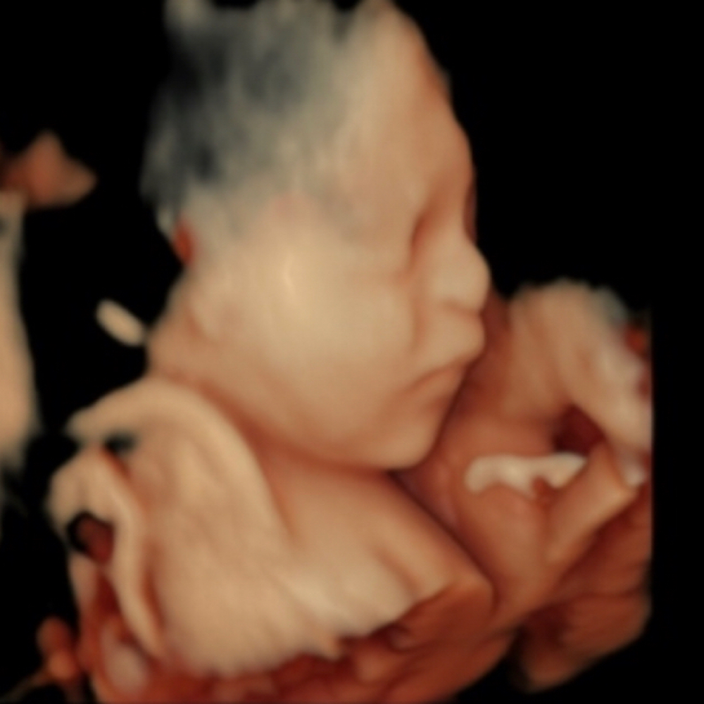 Add a Peek Of HD to Any Package at Hello Baby 3d 4d Ultrasound Studio LLC in Bakersfield, CA