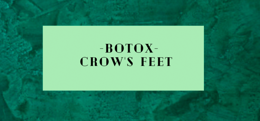 Crow’s Feet