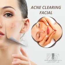 Acne Clearing Facial