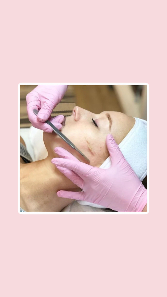 Dermaplaning