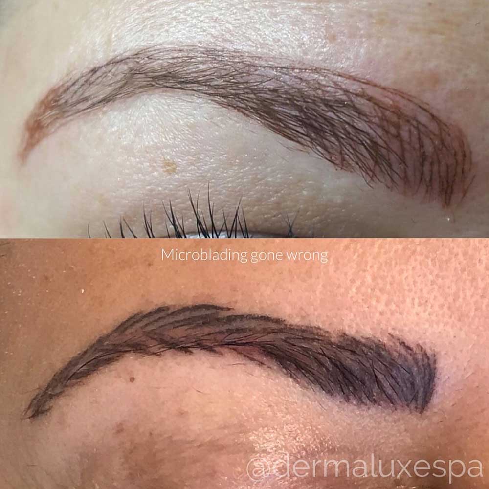 Brows Correction And Coverups