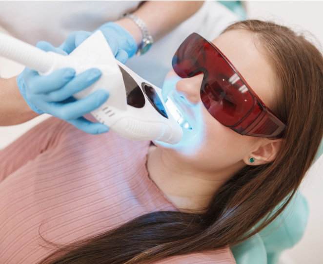 Teeth Whitening