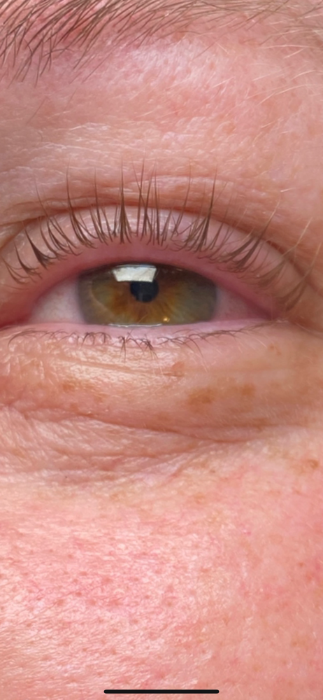 Lash Lift