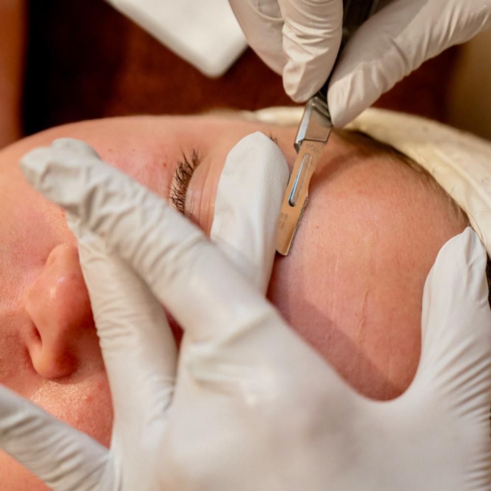 Dermaplane Add On at SoulSkin Aesthetics in Niles, MI
