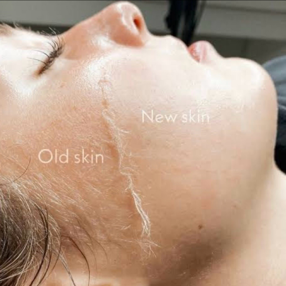 Dermaplaning Facial at 3CSkin, LLC in Wauchula, FL