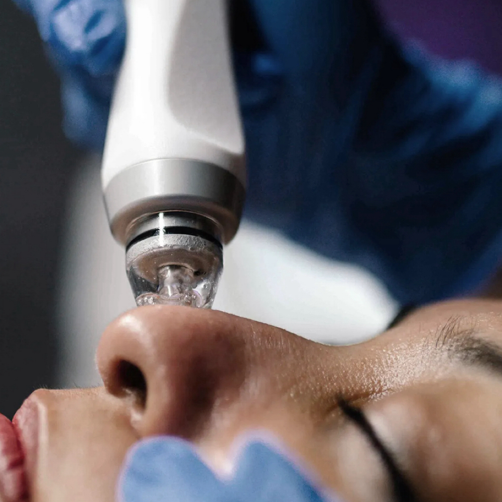 Glacē Hydrodermabrasion Facial at My Way Aesthetics in Melbourne, FL