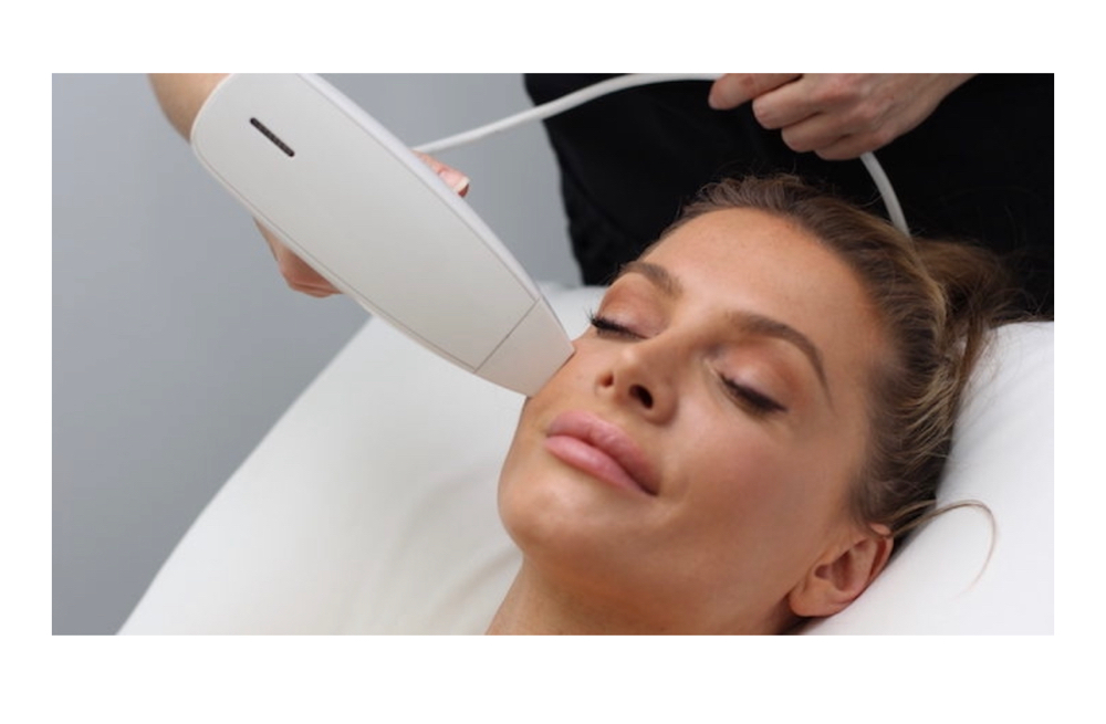 RF Microneedling Skin Resurfacing