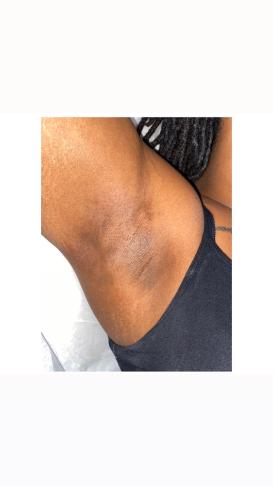 Underarm Wax