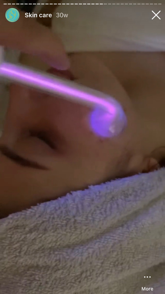High Frequency Add On at Body And Skin By Trin in Murrieta, CA