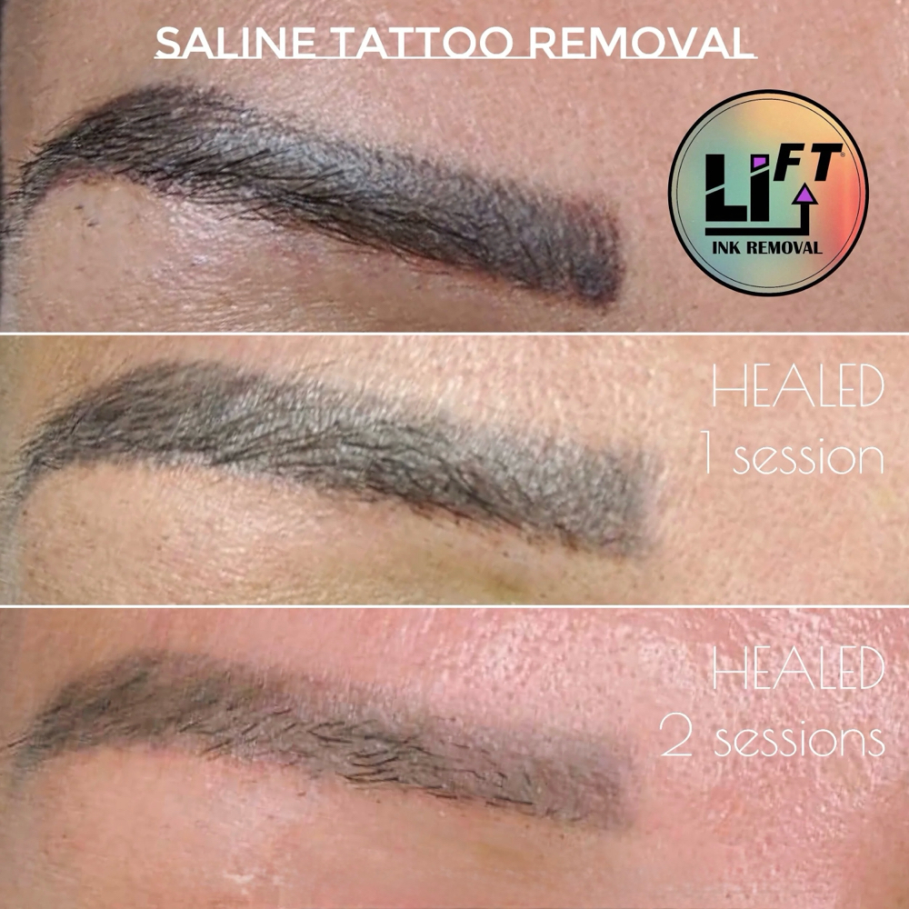 Li-FT Saline Removal at Permanent Makeup Artist -Nashey  Benavides in Eagle Pass, TX