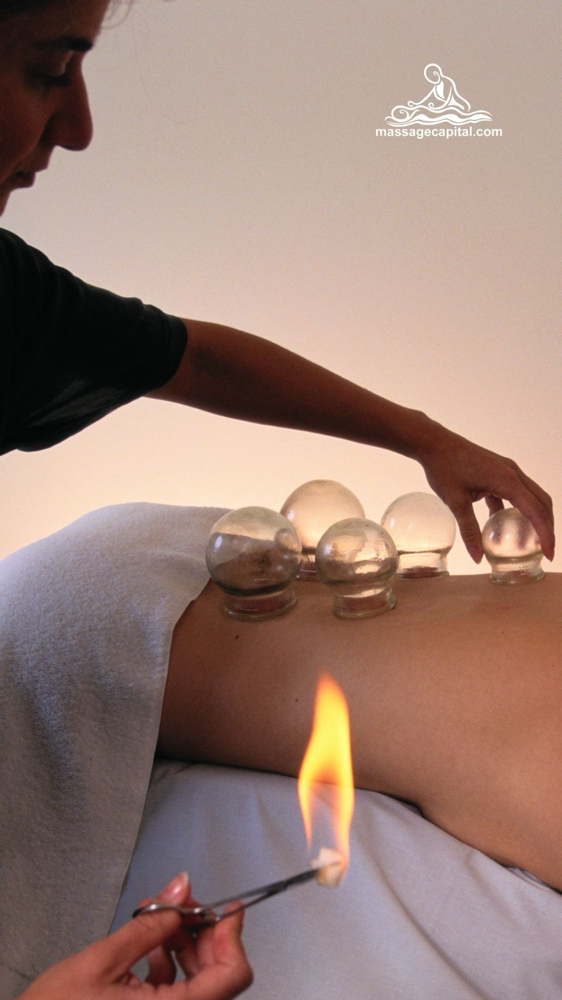 Cupping (Coming Soon)