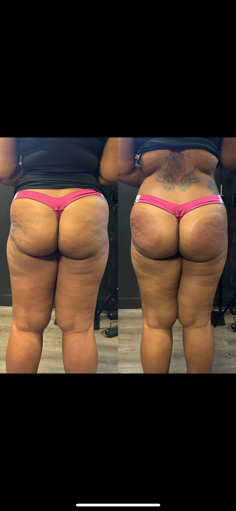 Booty Filler Model Pricing