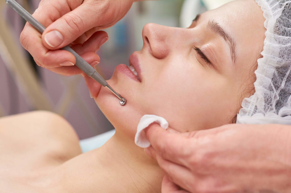 Extractions Facial