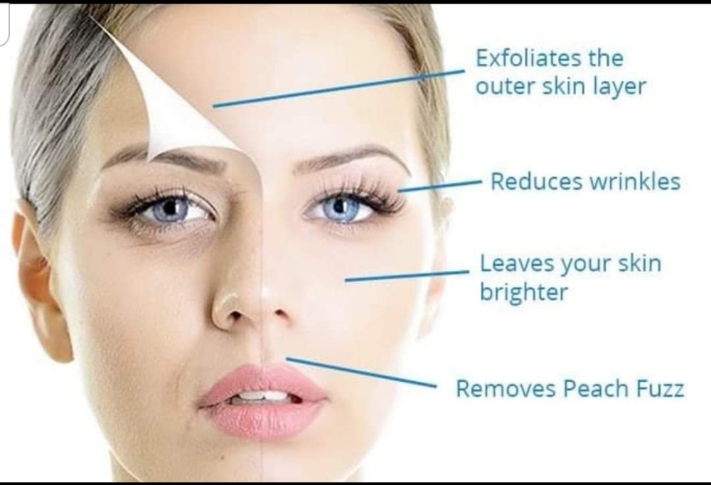 Dermaplane Facial