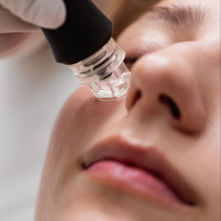 Hydro-Glow Deep Pore Cleanse at Idaho Beauty Lounge in Eagle, ID