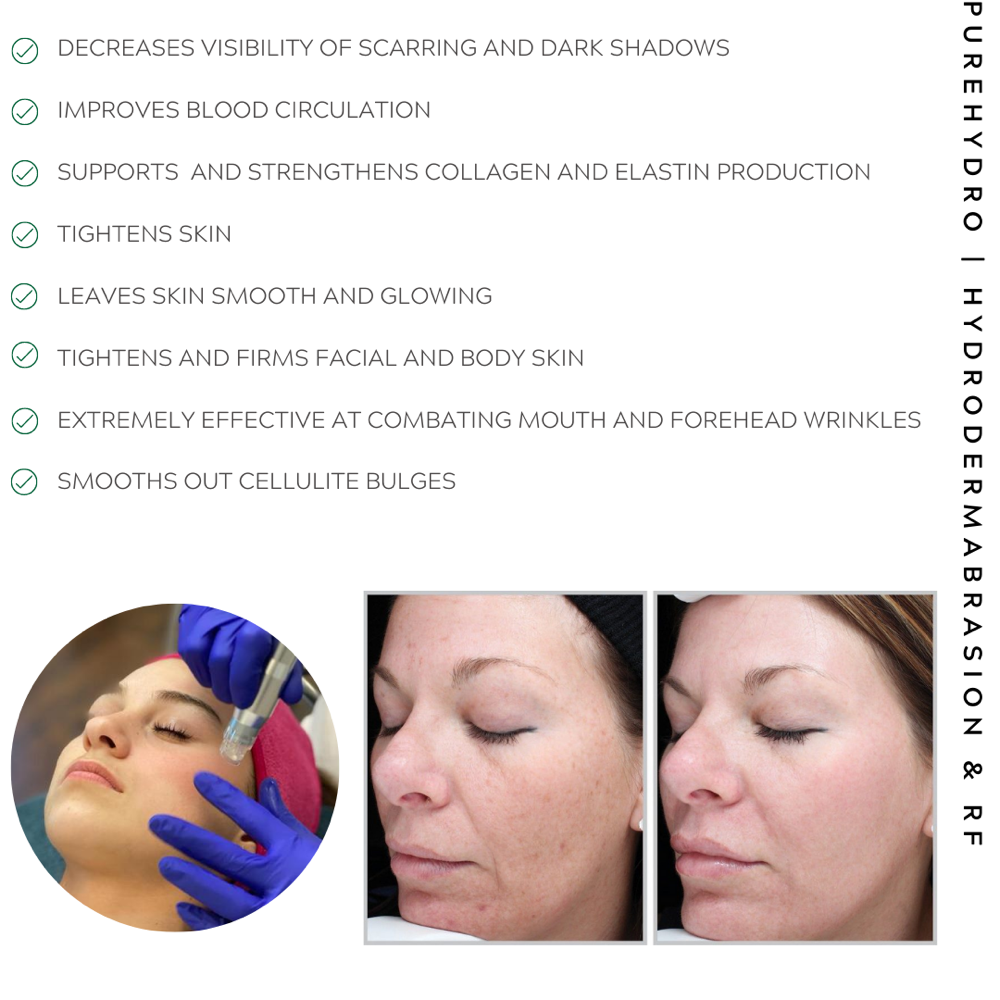Hydroglow Facial