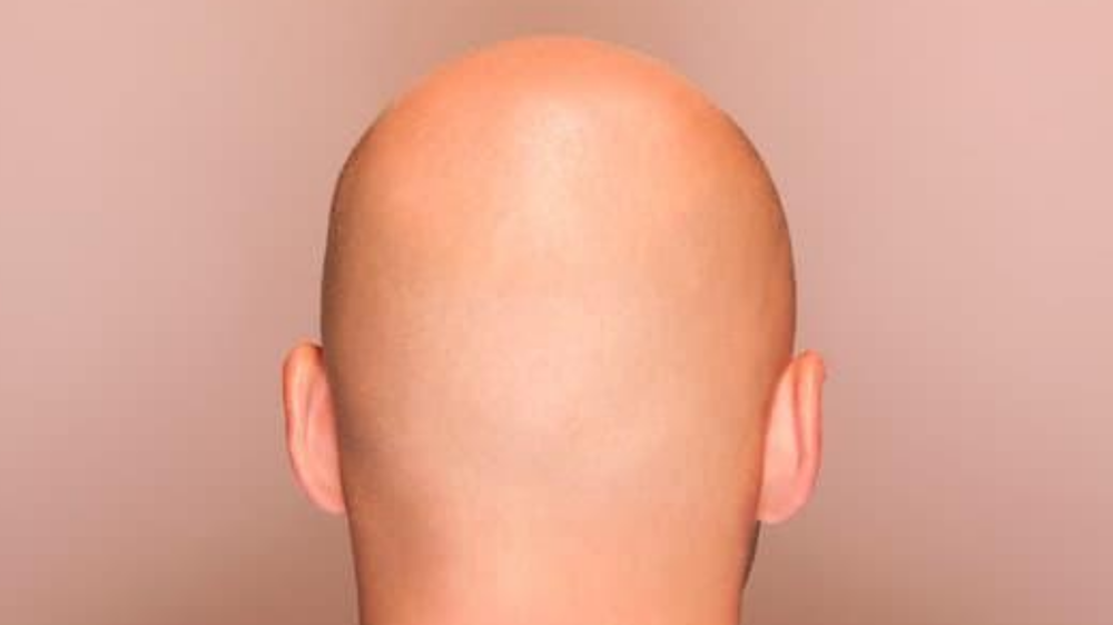 The Bald Eagle