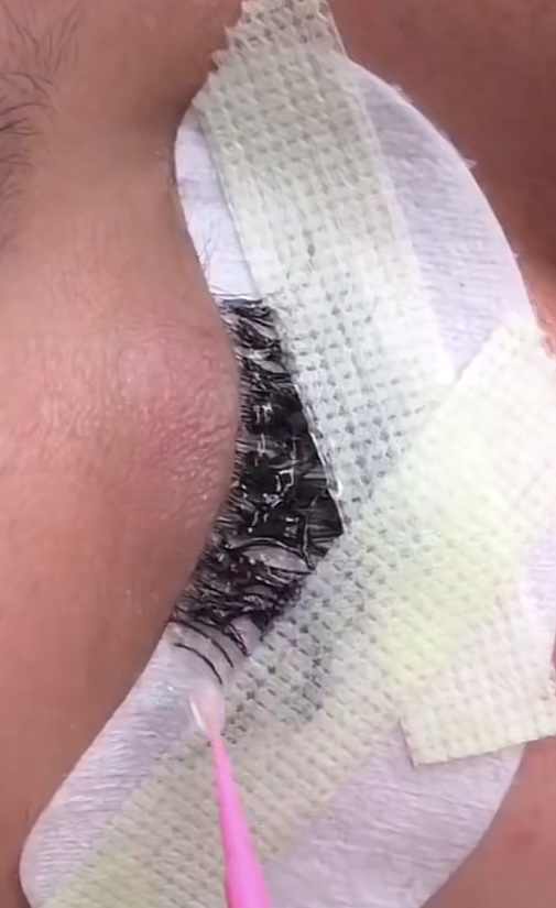 Lash Removal