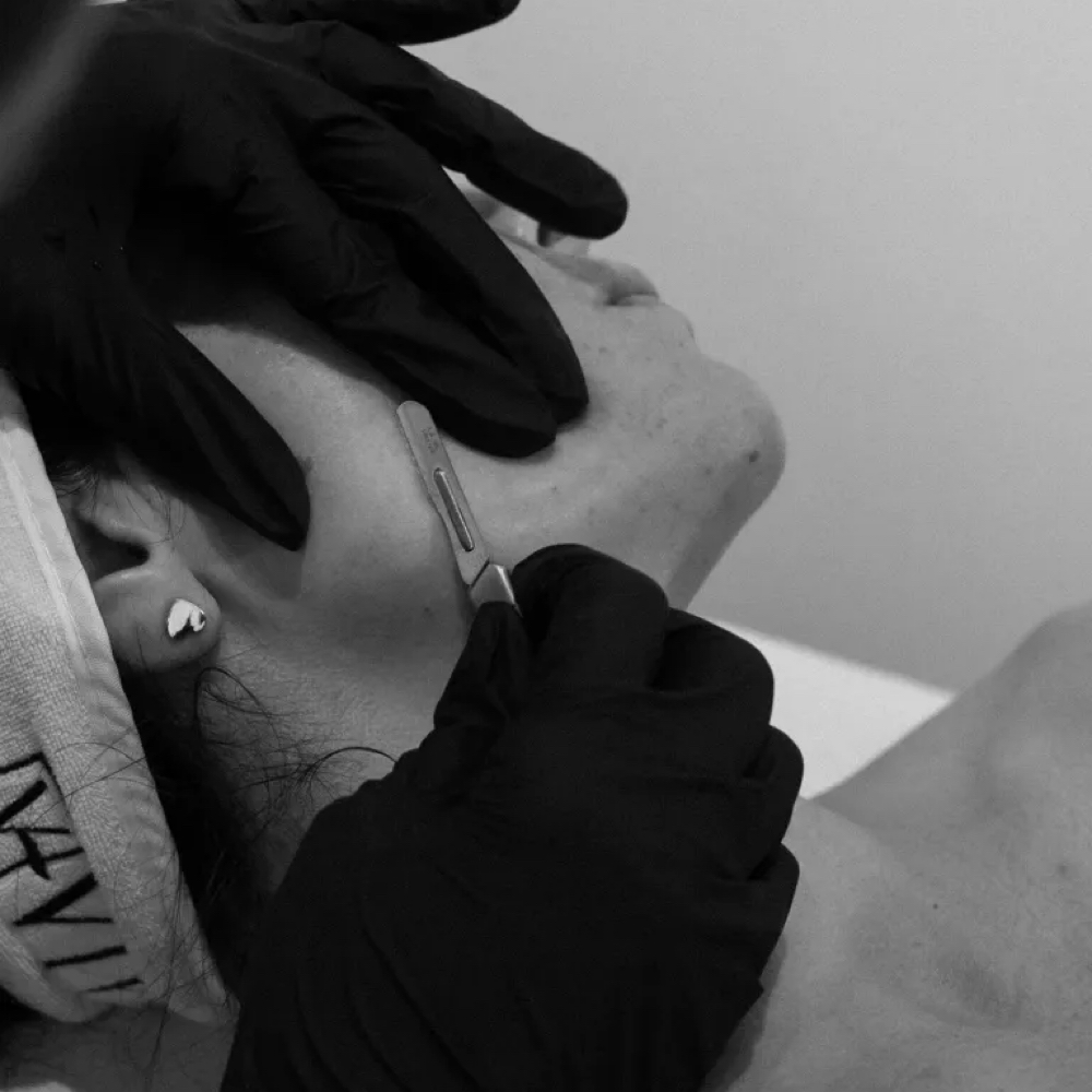 Haven Dermaplaning Facial at Beauty Haven by Alyssa in New York Mills, NY