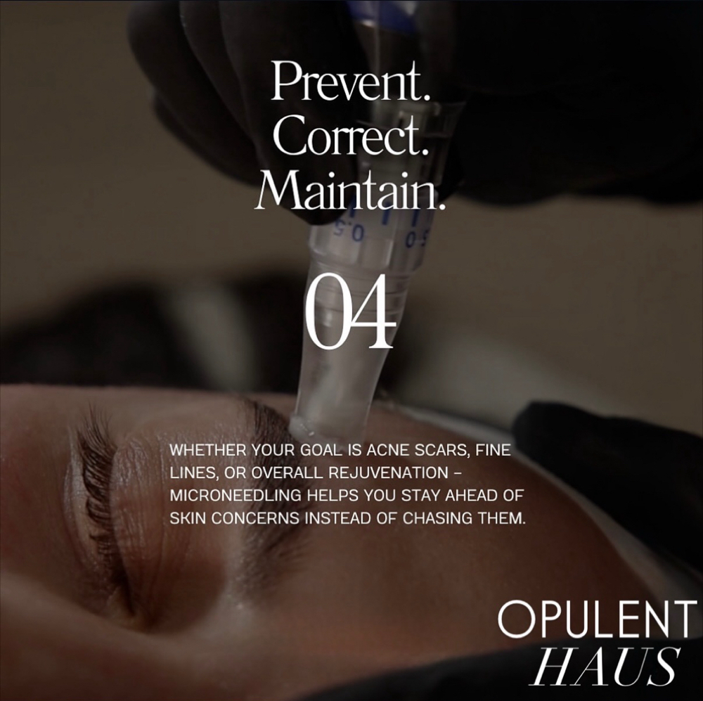 INTRO MICRONEEDLING at Opulent Haus | The Skin Co. in Sarasota, FL