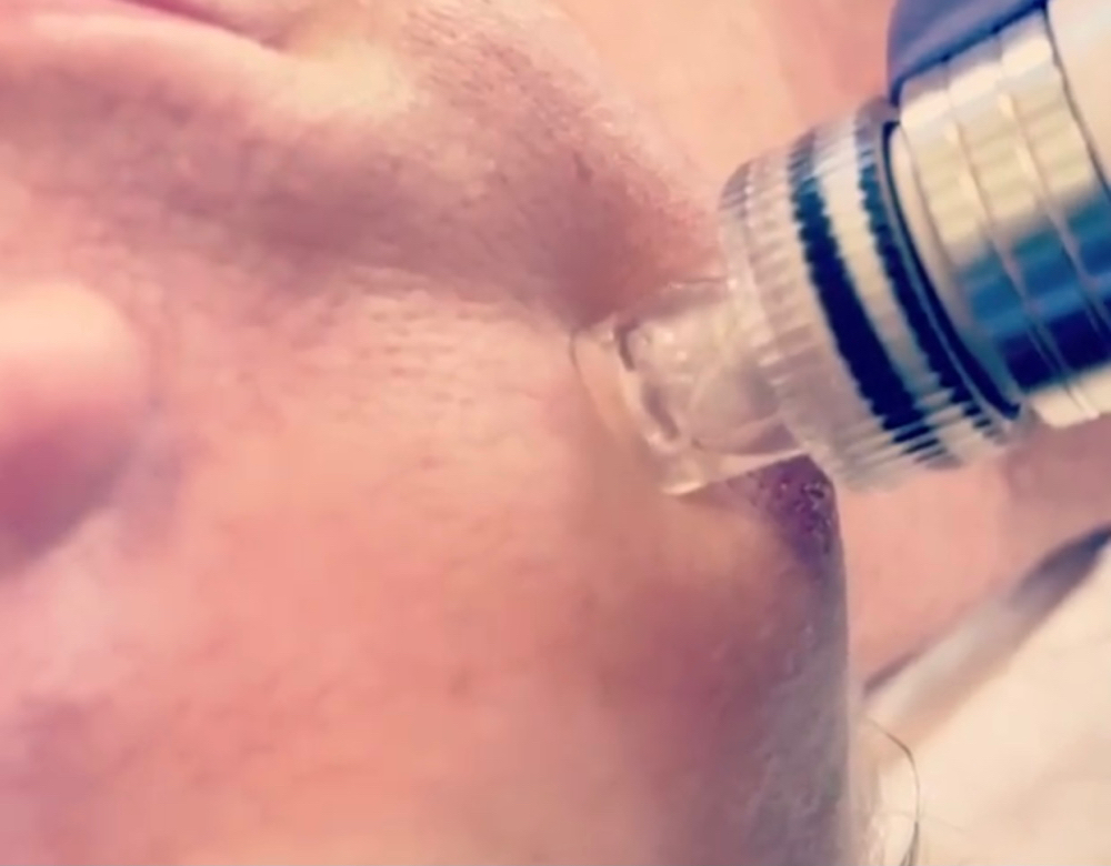 HYDROGLOW Facial