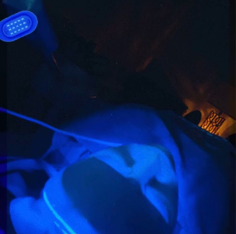 LED Light Therapy