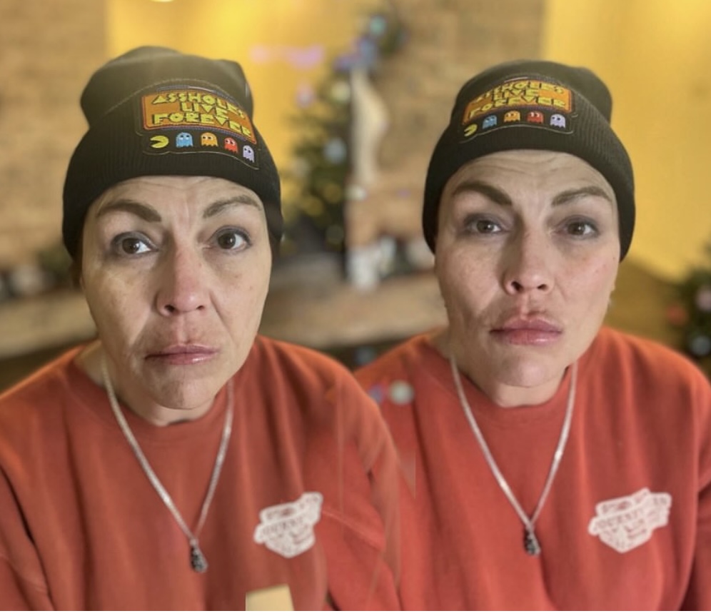 2ML Dermal Filler •CHEEK• at Glam X Sam MedBeauty in Andrews, TX